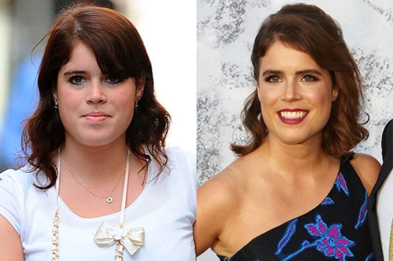 Princesa Eugenie: de gorda a magra
