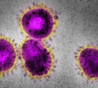 Coronavírus: escolas asseguram refeições a alunos carenciados